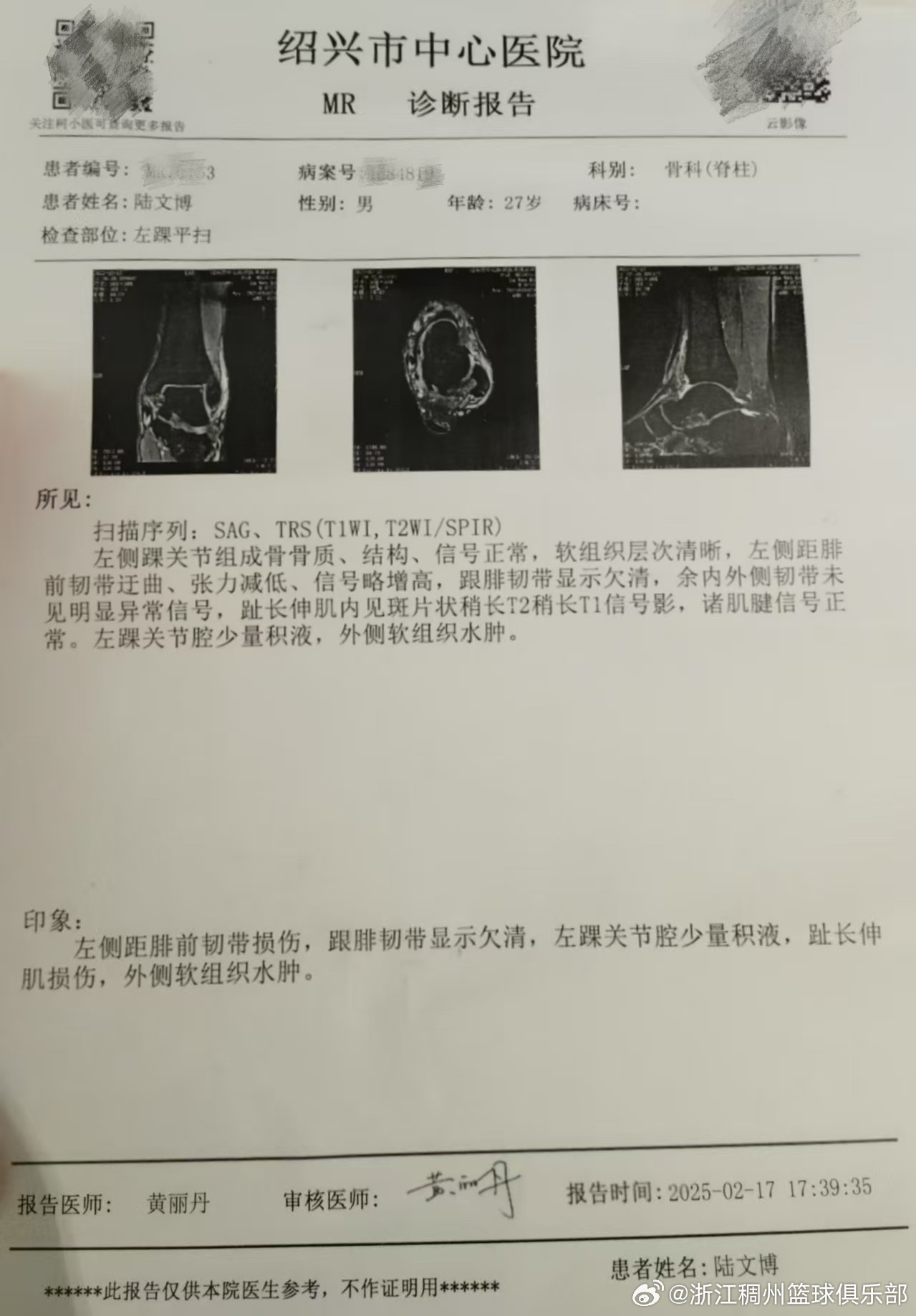 略显被动